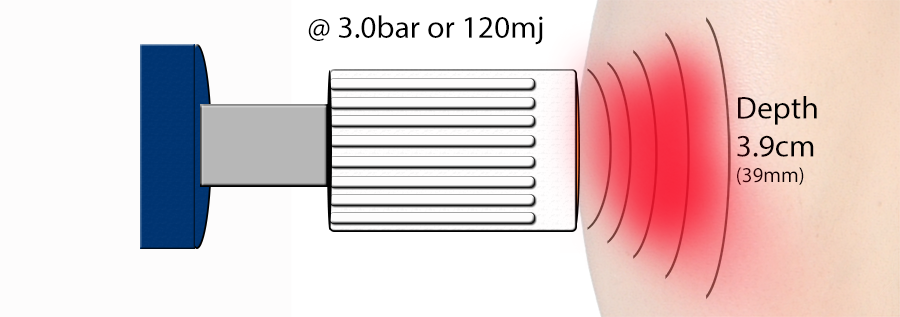 Dosage of Radial Shockwave